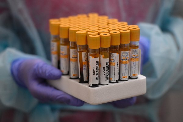  ������� ���������� �������������� ���������� covid-19 ������ 