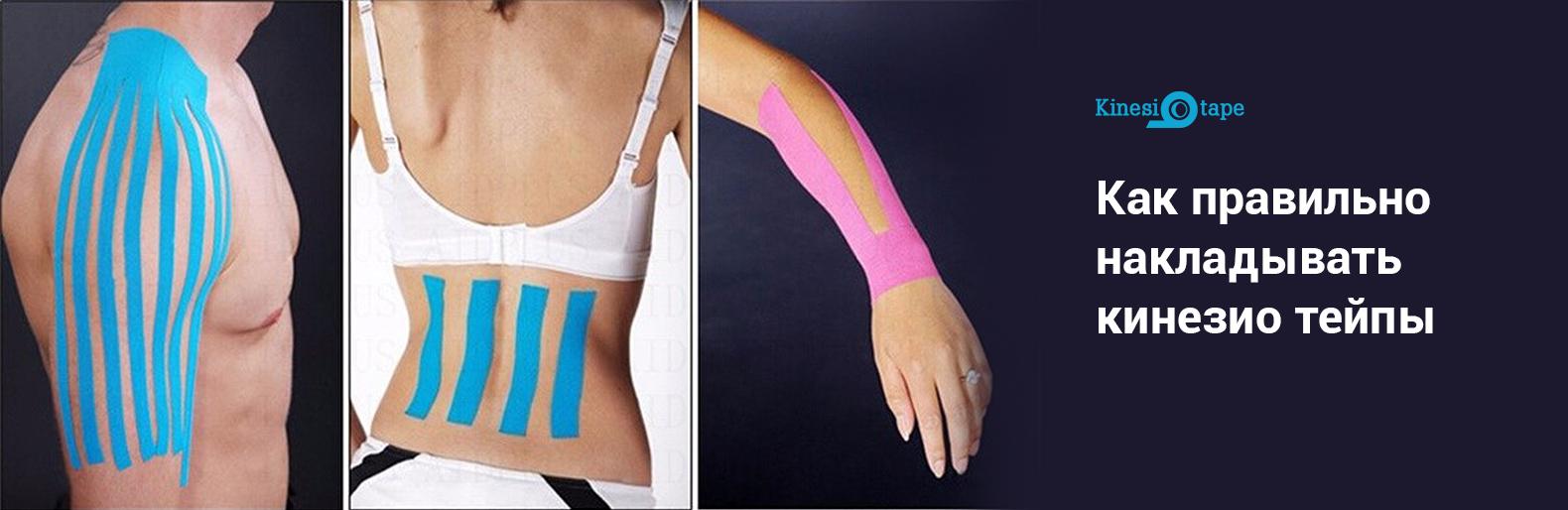 Kinesio tape – инструкция по применению пластырей нового поколения Kinesio tape – инструкция по применению пластырей нового поколения, Жежера Людмила