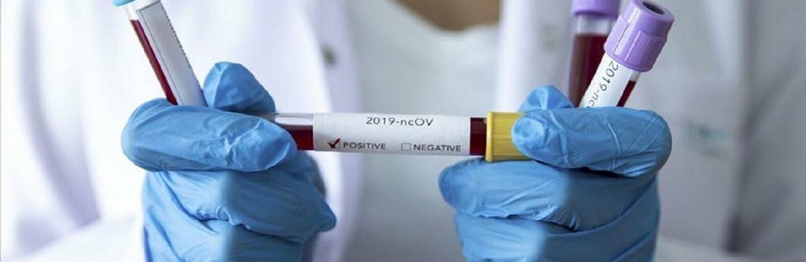 Коронавирус в Украине 2 апреля: почти 20 тысяч больных за сутки 