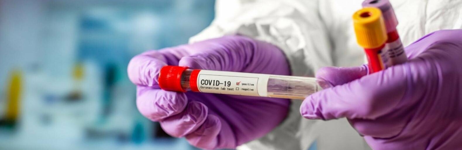 220 новых случаев инфицирования: статистика по COVID-19 в Днепре на утро 30 апреля