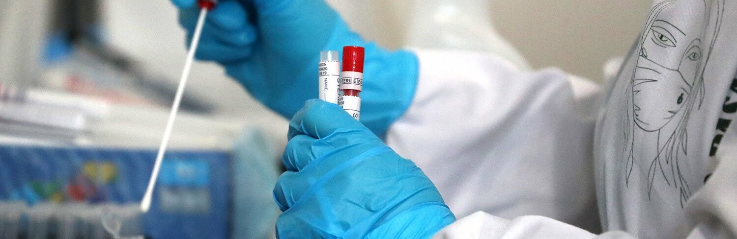 13 новых случаев инфицирования: статистика по COVID-19 в Днепре на утро 29 июня